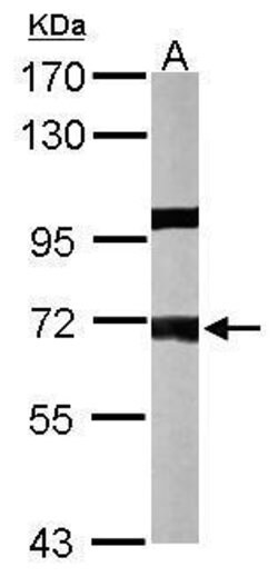 Invitrogen&trade;&nbsp;PPP1R16A Polyclonal Antibody