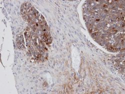 Mesothelin Polyclonal Antibody, Invitrogen 100 μL; Unconjugated:Antibodies,