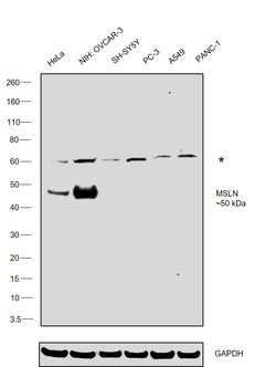 Mesothelin Polyclonal Antibody, Invitrogen 100 μL; Unconjugated:Antibodies,