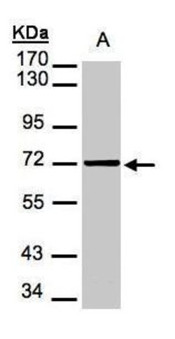 Mesothelin Polyclonal Antibody, Invitrogen 100 μL; Unconjugated:Antibodies,