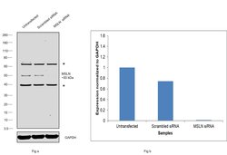 Mesothelin Polyclonal Antibody, Invitrogen 100 μL; Unconjugated:Antibodies,