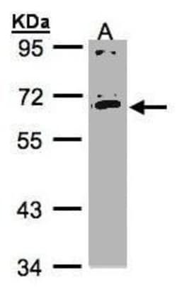 Invitrogen IL17RC Polyclonal Antibody 100 &mu;L; Unconjugated:Antibodies,