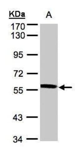 Invitrogen XPNPEP3 Polyclonal Antibody 100 &mu;L; Unconjugated:Antibodies,