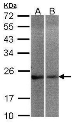 Invitrogen NCS1 Polyclonal Antibody 100 &mu;L | Buy Online | Invitrogen&trade; | Fisher Scientific