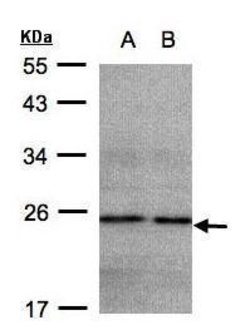 Invitrogen NDUFB9 Polyclonal Antibody 100 &mu;L | Buy Online | Invitrogen&trade; | Fisher Scientific