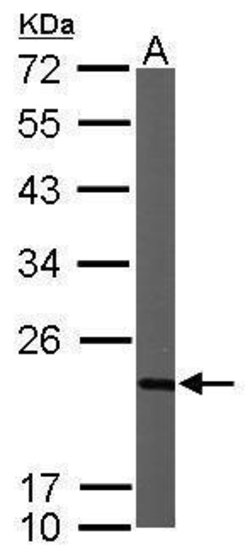 Invitrogen NDUFB9 Polyclonal Antibody 100 &mu;L | Buy Online | Invitrogen&trade; | Fisher Scientific