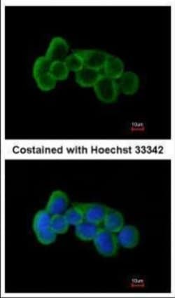 Invitrogen FLRT1 Polyclonal Antibody 100 &mu;L; Unconjugated:Antibodies,