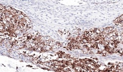 Invitrogen FLRT1 Polyclonal Antibody 100 &mu;L; Unconjugated:Antibodies,