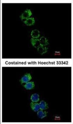 GSTA2 Polyclonal Antibody:Antibodies, Polyclonal