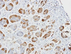 GSTA2 Polyclonal Antibody:Antibodies, Polyclonal
