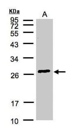 GSTA2 Polyclonal Antibody:Antibodies, Polyclonal