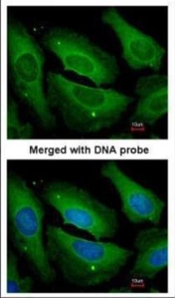 Invitrogen PP1 gamma Polyclonal Antibody 100 &mu;L; Unconjugated:Antibodies,