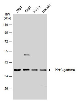Invitrogen PP1 gamma Polyclonal Antibody 100 &mu;L; Unconjugated:Antibodies,