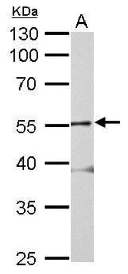 Invitrogen GLRA2 Polyclonal Antibody 100 &mu;L; Unconjugated:Antibodies,