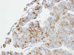 Invitrogen GST Omega 1 140A Polyclonal Antibody 100 &mu;L; Unconjugated:Antibodies,