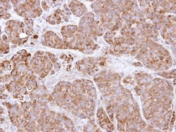 Invitrogen Bcl-X Polyclonal Antibody 100 &mu;L; Unconjugated:Antibodies,