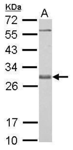 Invitrogen Bcl-X Polyclonal Antibody 100 &mu;L; Unconjugated:Antibodies,