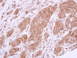 Invitrogen Bcl-X Polyclonal Antibody 100 &mu;L; Unconjugated:Antibodies,