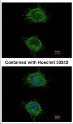 Invitrogen NDUFS4 Polyclonal Antibody 100 &mu;L | Buy Online | Invitrogen&trade; | Fisher Scientific