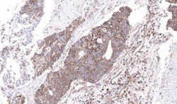 Invitrogen NDUFS4 Polyclonal Antibody 100 &mu;L | Buy Online | Invitrogen&trade; | Fisher Scientific