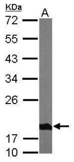 Invitrogen NDUFS4 Polyclonal Antibody 100 &mu;L | Buy Online | Invitrogen&trade; | Fisher Scientific