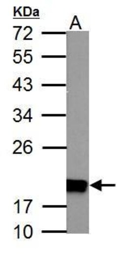 Invitrogen NDUFS4 Polyclonal Antibody 100 &mu;L | Buy Online | Invitrogen&trade; | Fisher Scientific