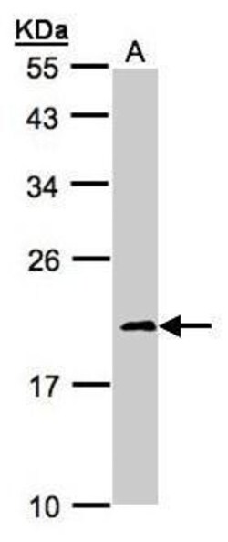 Invitrogen NDUFS4 Polyclonal Antibody 100 &mu;L | Buy Online | Invitrogen&trade; | Fisher Scientific