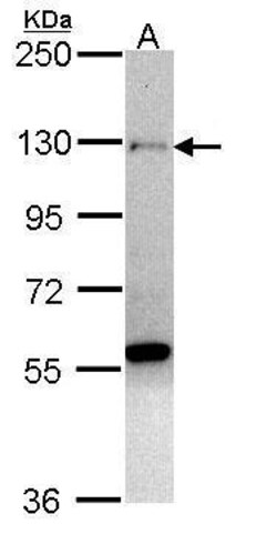 Invitrogen ZNF574 Polyclonal Antibody 100 μL; Unconjugated:Antibodies,