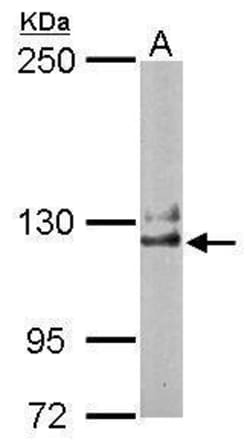 Invitrogen NCKAP1 Polyclonal Antibody 100 &mu;L; Unconjugated:Antibodies,