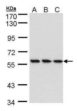 Invitrogen HCE Polyclonal Antibody 100 &mu;L; Unconjugated:Antibodies,