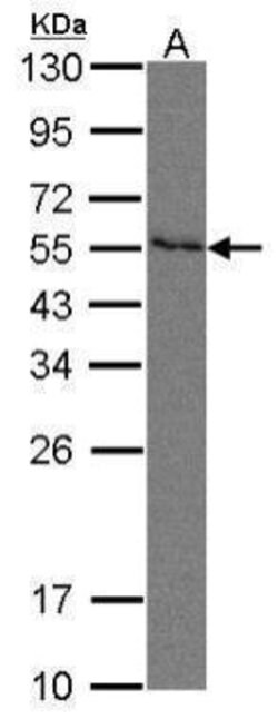 Invitrogen Nectin 2 Polyclonal Antibody 100 &mu;L; Unconjugated:Antibodies,