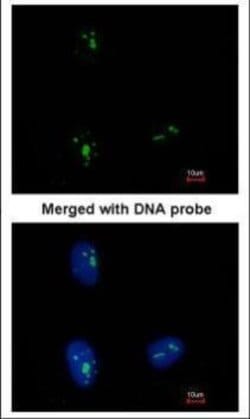 KRR1 Polyclonal Antibody:Antibodies, Polyclonal