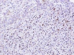 KRR1 Polyclonal Antibody:Antibodies, Polyclonal