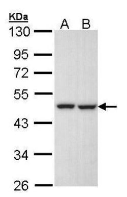 KRR1 Polyclonal Antibody:Antibodies, Polyclonal