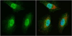 Invitrogen WBSCR22 Polyclonal Antibody 100 &mu;L; Unconjugated:Antibodies,