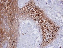 Invitrogen WBSCR22 Polyclonal Antibody 100 &mu;L; Unconjugated:Antibodies,