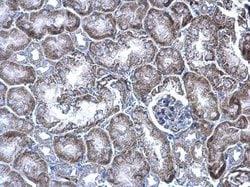 Invitrogen WBSCR22 Polyclonal Antibody 100 &mu;L; Unconjugated:Antibodies,