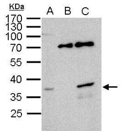 Invitrogen WBSCR22 Polyclonal Antibody 100 &mu;L; Unconjugated:Antibodies,