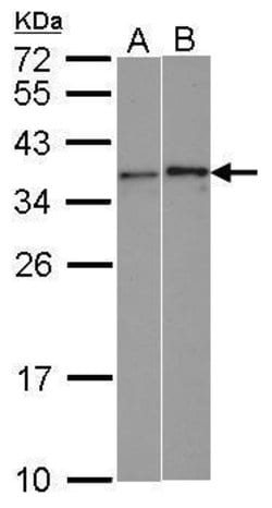 Invitrogen WBSCR22 Polyclonal Antibody 100 &mu;L; Unconjugated:Antibodies,