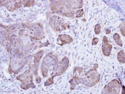 Invitrogen Calsequestrin 2 Polyclonal Antibody 100 &mu;L; Unconjugated:Antibodies,