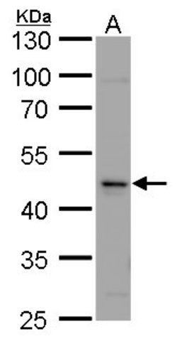 Invitrogen Calsequestrin 2 Polyclonal Antibody 100 &mu;L; Unconjugated:Antibodies,