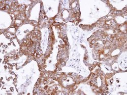 Invitrogen PANK1 Polyclonal Antibody 100 μL; Unconjugated:Antibodies,