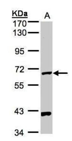 Invitrogen PANK1 Polyclonal Antibody 100 μL; Unconjugated:Antibodies,