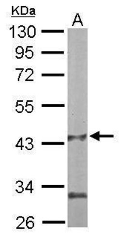 Invitrogen PANK1 Polyclonal Antibody 100 μL; Unconjugated:Antibodies,