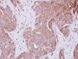 Invitrogen STAM Polyclonal Antibody 100 &mu;L; Unconjugated:Antibodies,