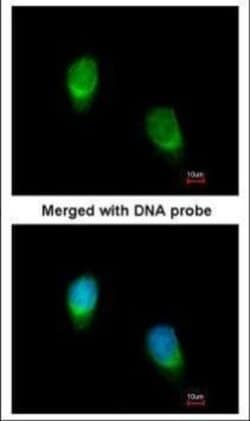 Invitrogen WNT11 Polyclonal Antibody 100 &mu;L | Buy Online | Invitrogen&trade; | Fisher Scientific