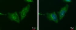 Invitrogen&trade;&nbsp;WNT11 Polyclonal Antibody