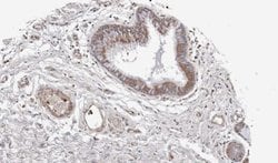 Invitrogen WNT11 Polyclonal Antibody 100 &mu;L | Buy Online | Invitrogen&trade; | Fisher Scientific