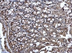 Invitrogen WNT11 Polyclonal Antibody 100 &mu;L | Buy Online | Invitrogen&trade; | Fisher Scientific