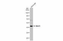Invitrogen WNT11 Polyclonal Antibody 100 &mu;L | Buy Online | Invitrogen&trade; | Fisher Scientific
